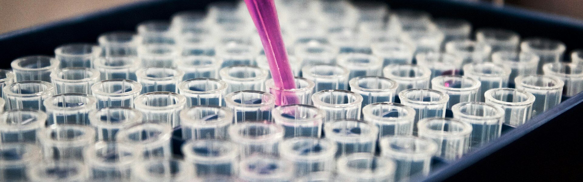 Pipeta nad statywem z probówkami w laboratorium